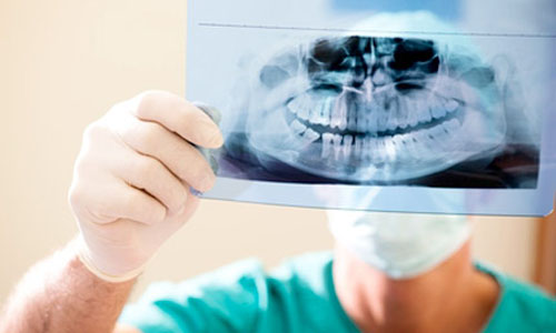 Radiografia dental